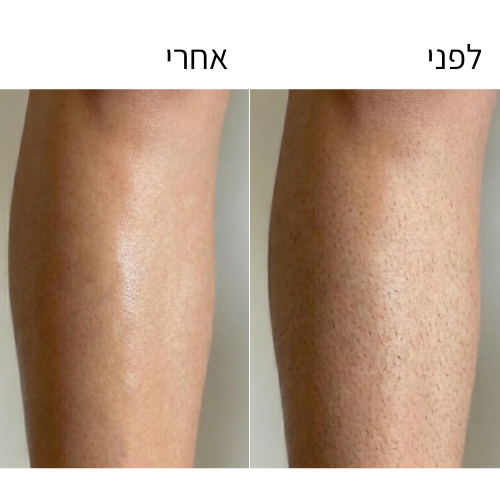 מכונת הגילוח של Lanvero